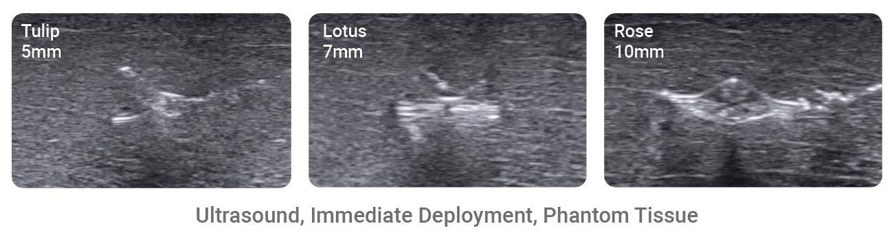 LumiMARK markers under ultrasound at immediate deployment in phantom tissue